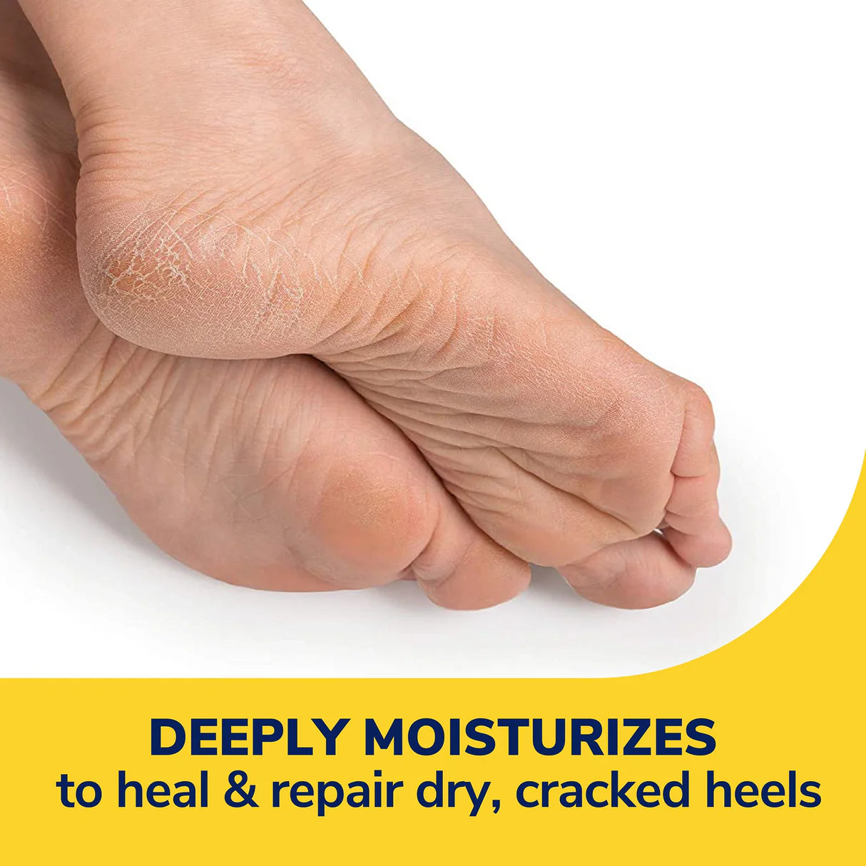 Dr. Scholl’s Severe Cracked Heel Repair Restoring Balm - 70 gm