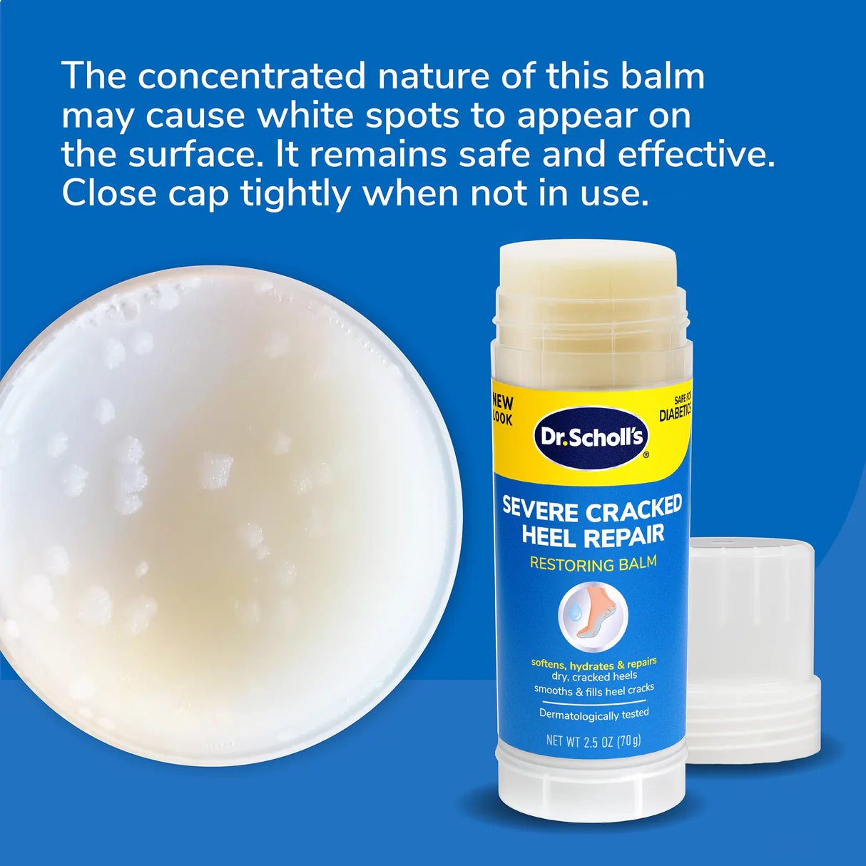 Dr. Scholl’s Severe Cracked Heel Repair Restoring Balm - 70 gm