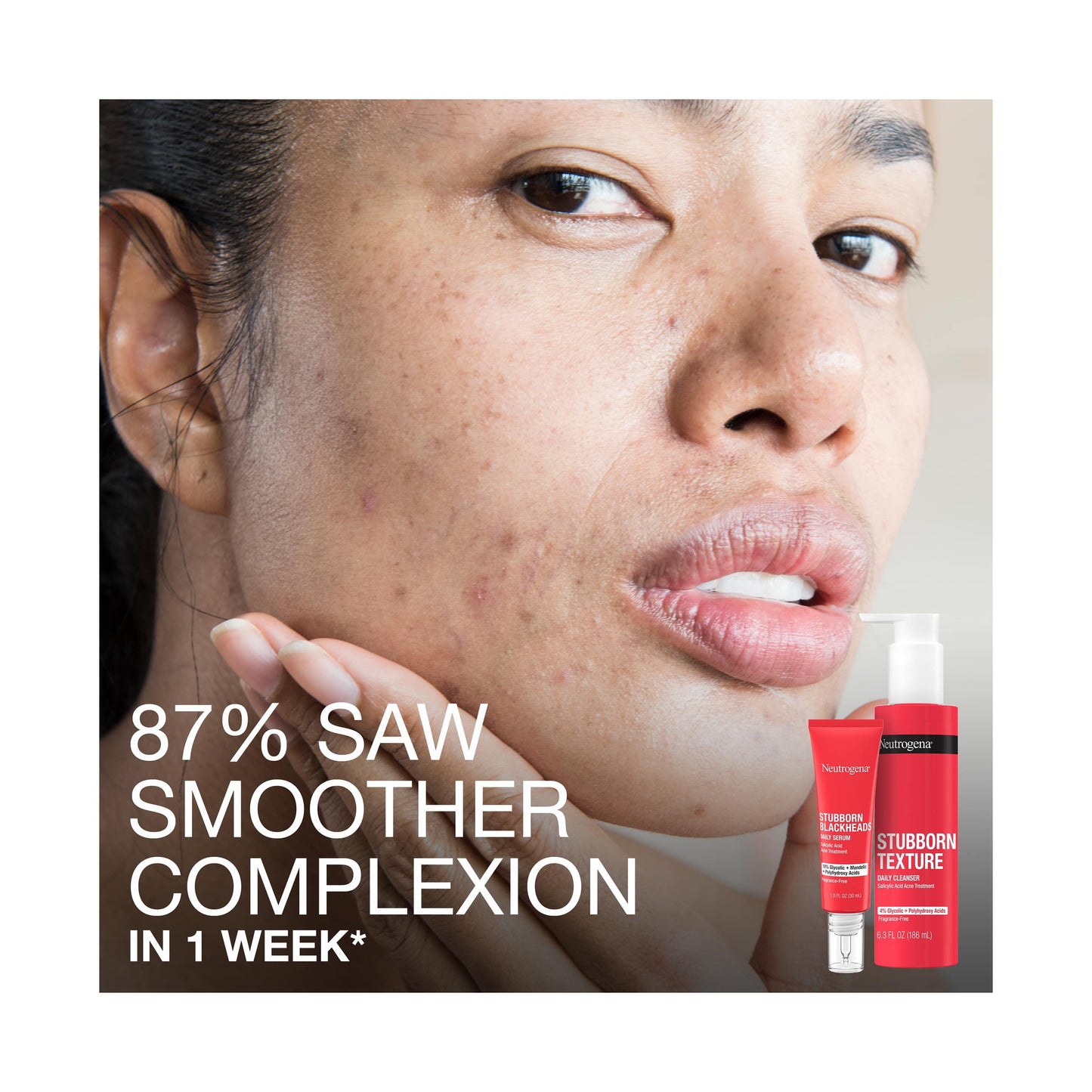 Stubborn Texture™ Acne Cleanser for Textured Skin