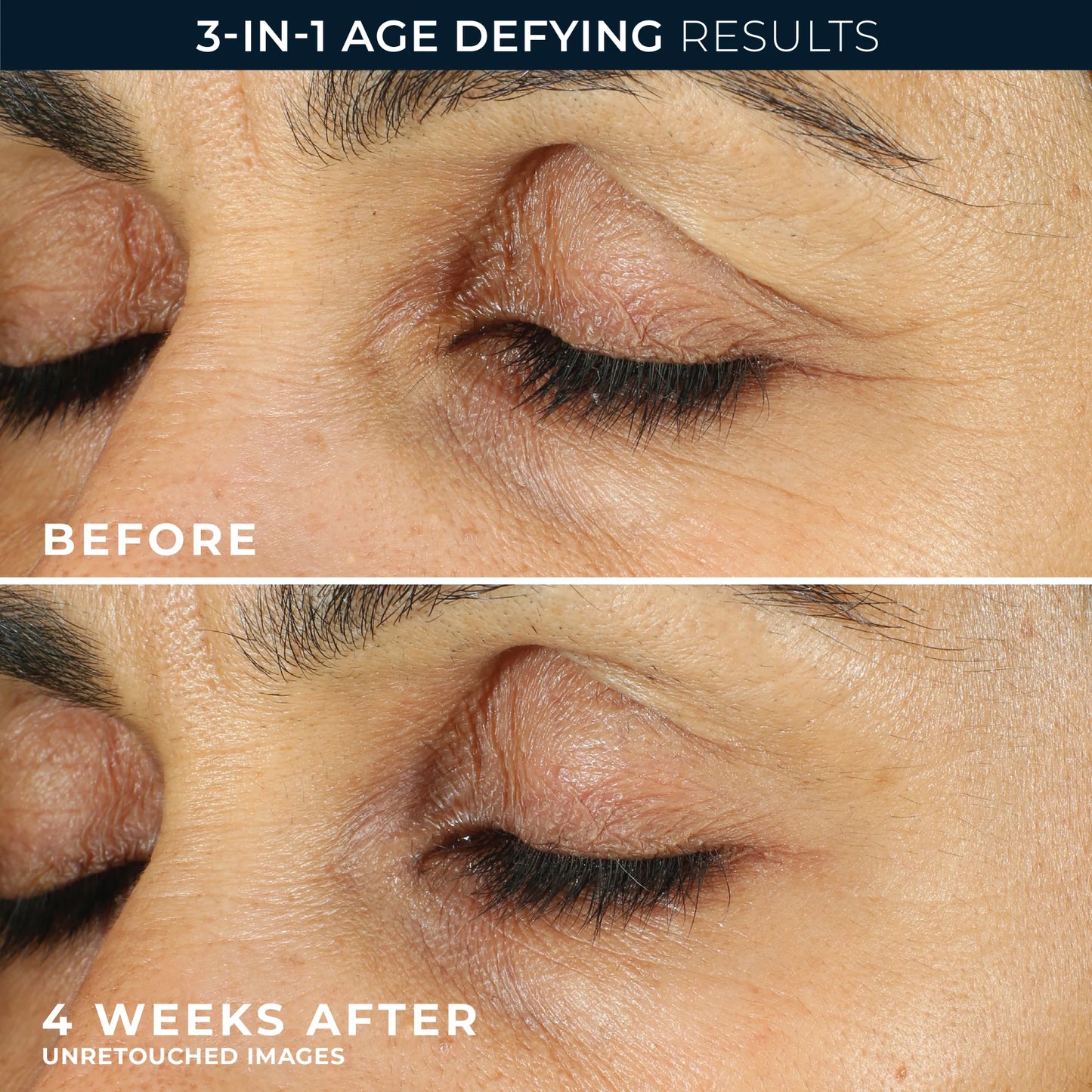 RoC RETINOL CORREXION® Line Smoothing Eye Cream - 15 ml