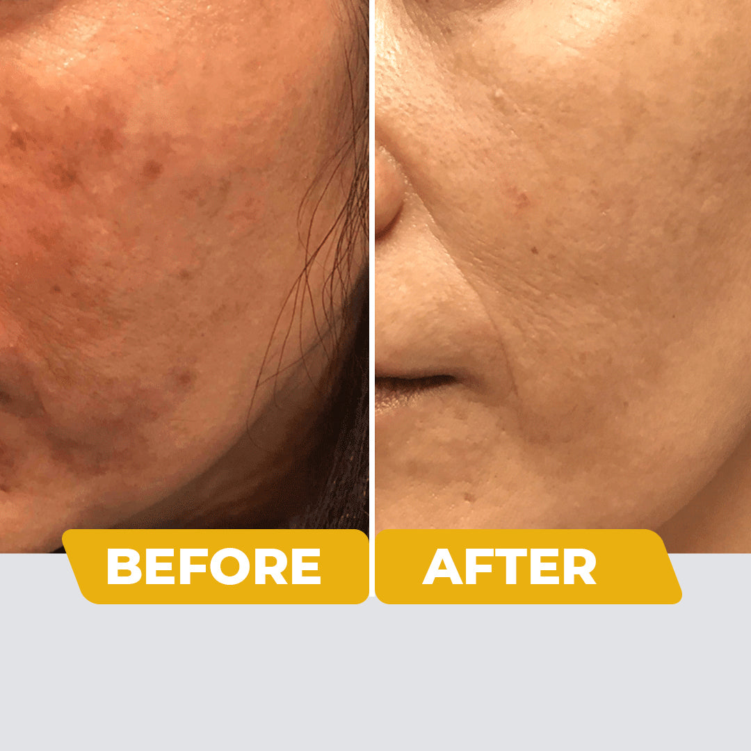 Oily Skin SPF 60 Sunscreen With Kakadu Plum, Acai Berry & Chia Seeds - 100gm