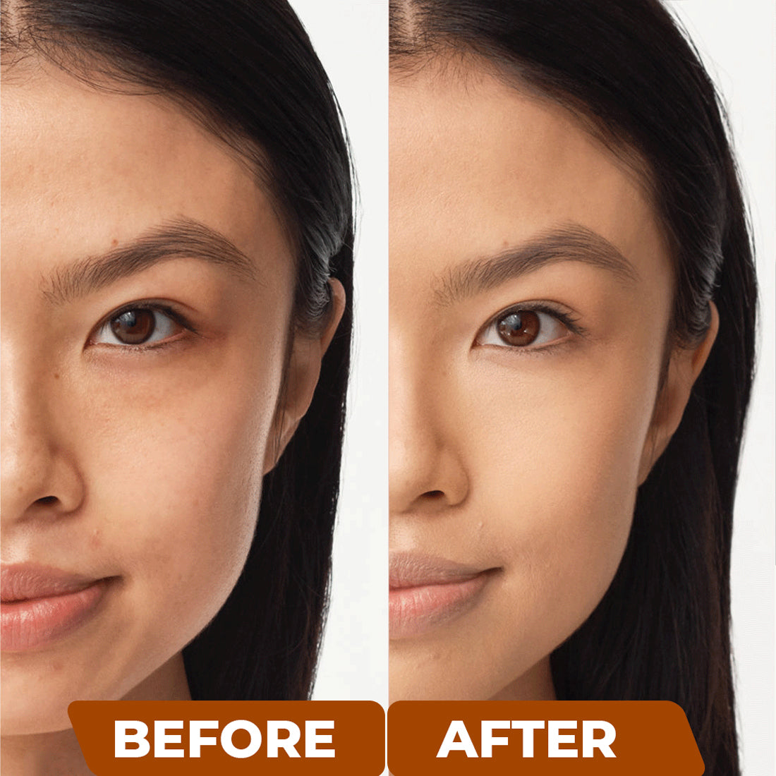 Anti pigmentation serum