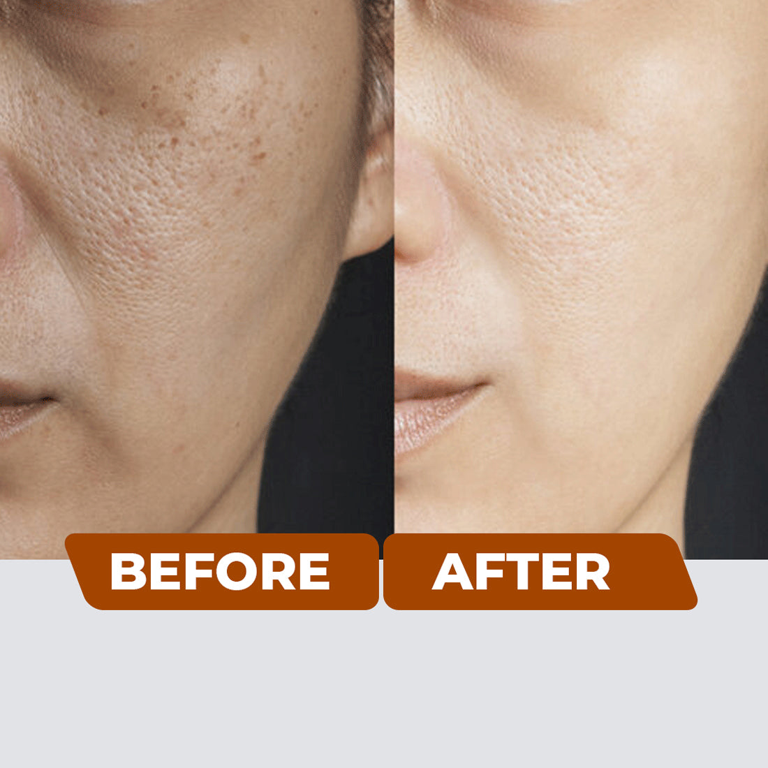 Anti Pigmentation Cream