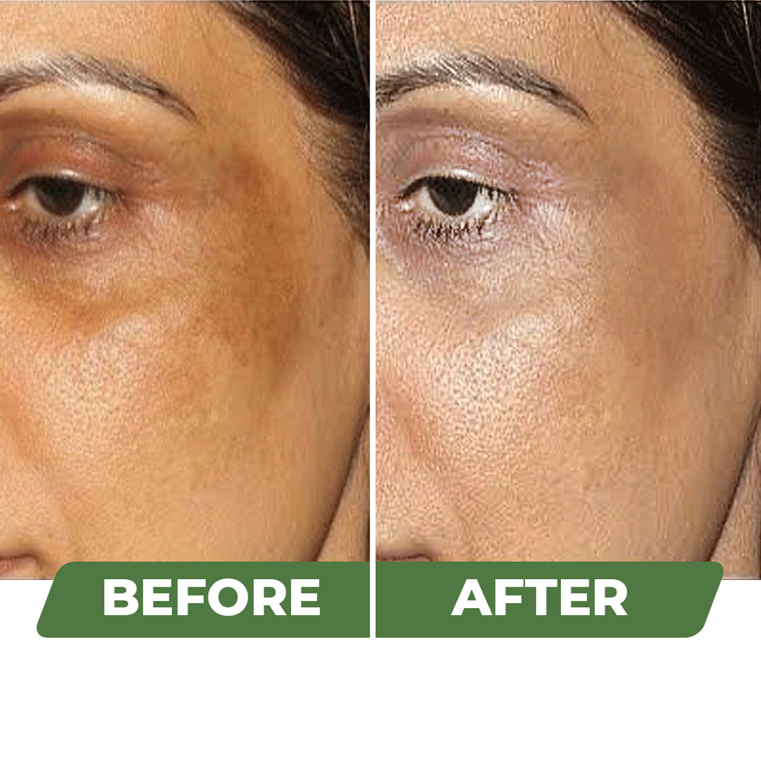 Skin Lightening Cream