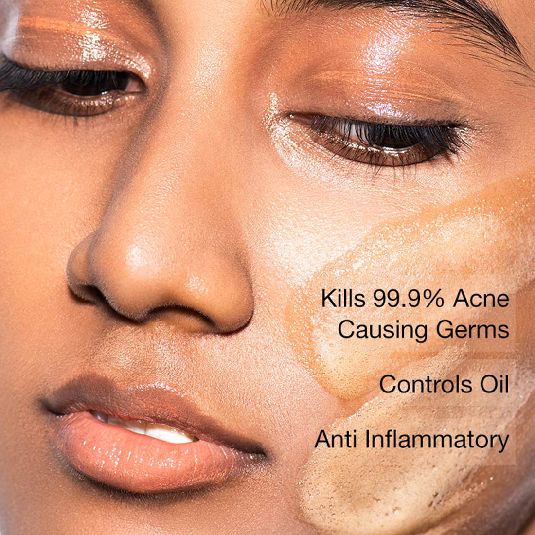 mCaffeine Anti Acne Coffee Foaming Face Wash - Oil & Pimple Control Cleanser with Cinnamon & Vitamin E
