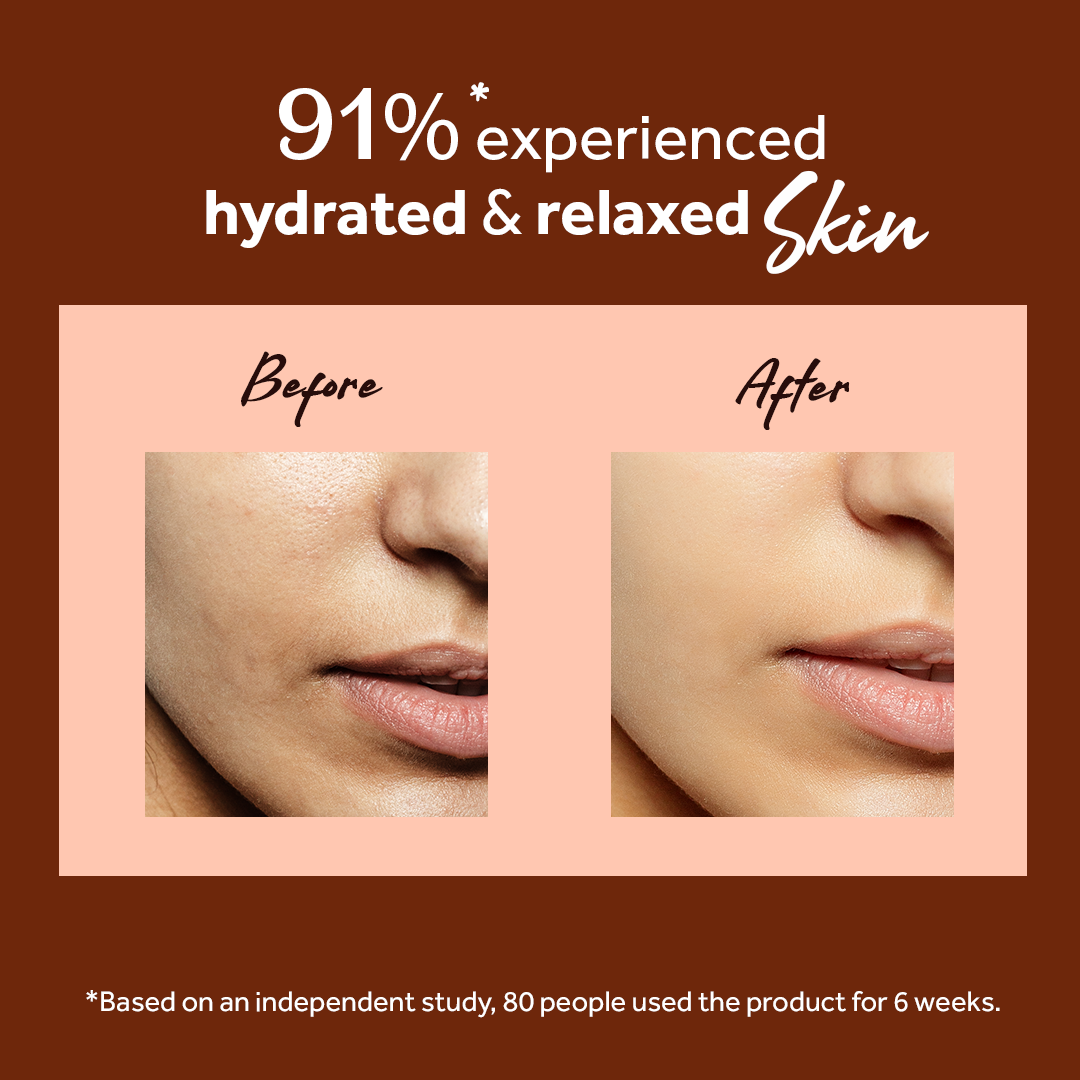 Atulya Sandalwood Essential Oil | Calms Skin, Earthy Fragrance | For Skin & Scalp | 15 ml