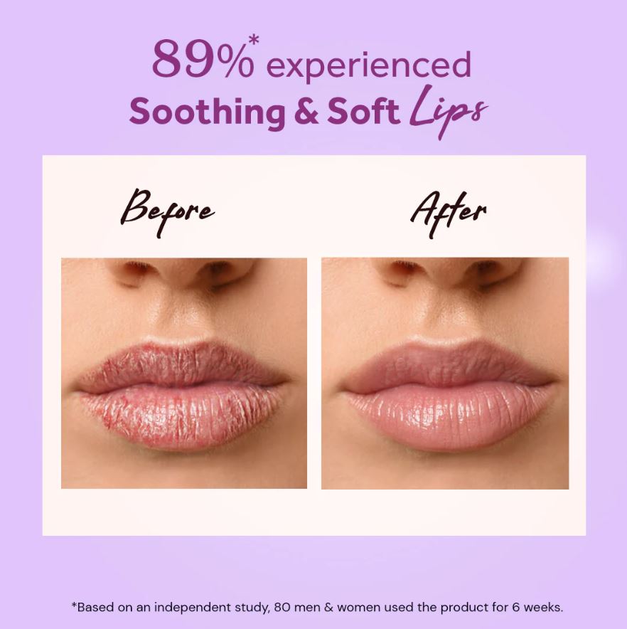 Atulya Wine Grape Fruit Natural Lip Balm | For Nourishing Lips - 5gm