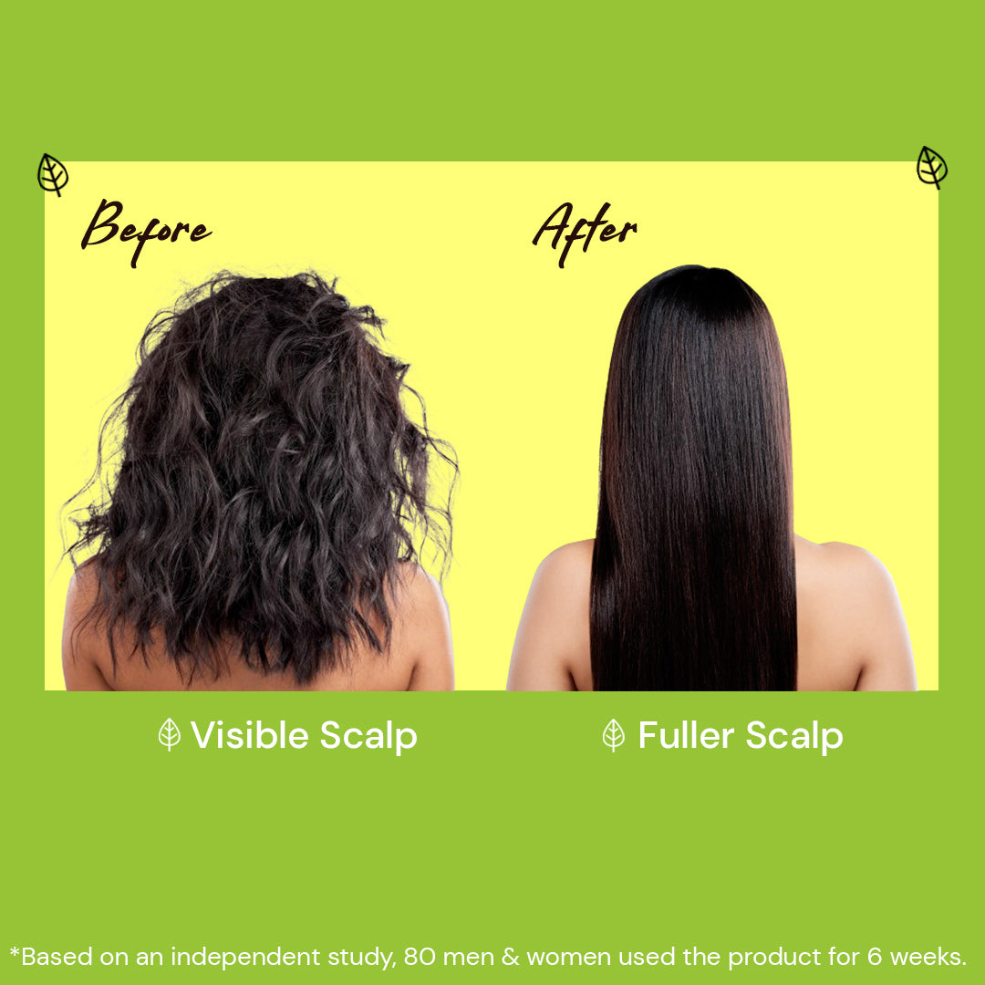 Atulya Amla & Bhringraj Hair Oil | Reduces Hair Fall, Boosts Strength | 200 ml