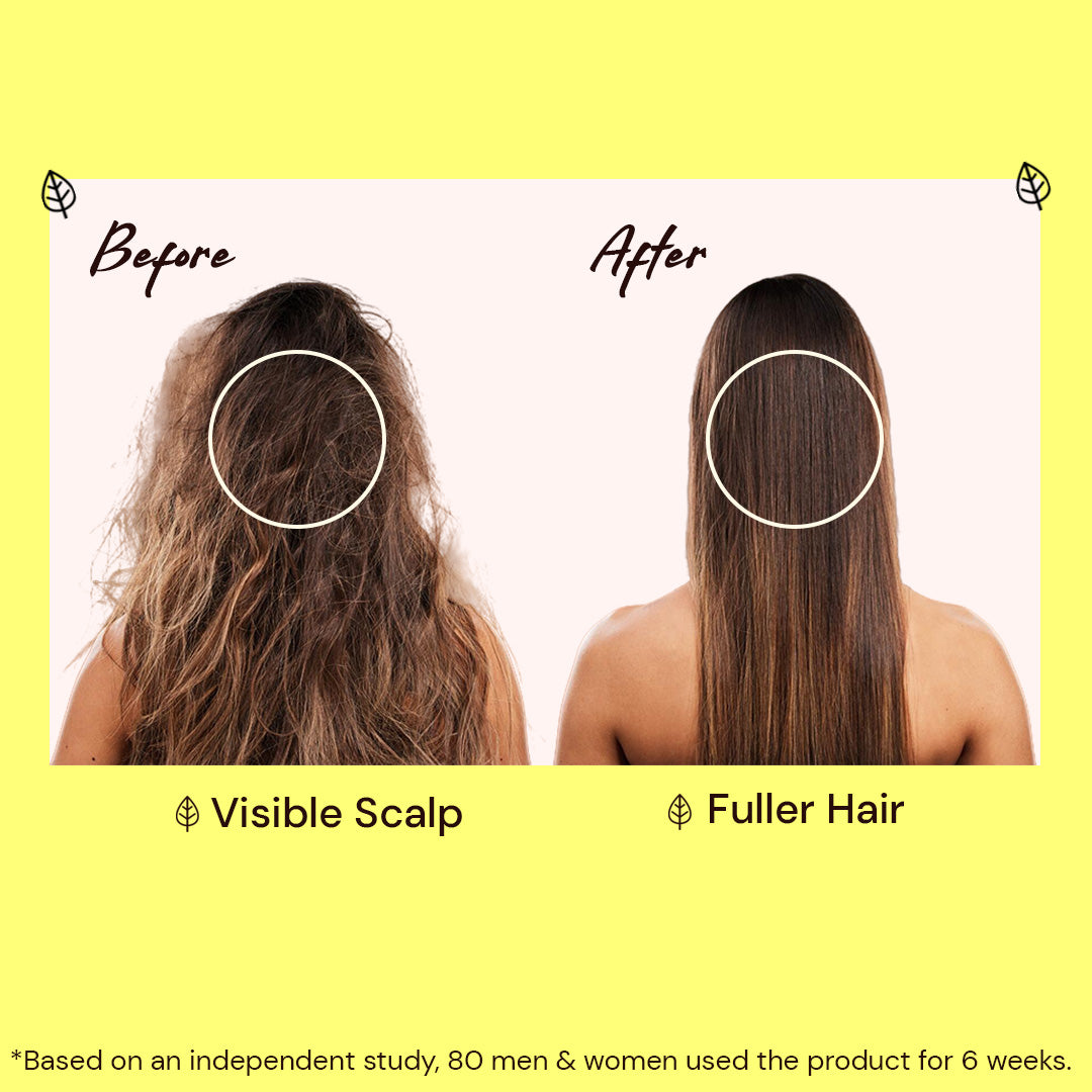 Atulya Amla & Bhringraj Shampoo | Deep Cleansing, Strengthens Hair | Sulphate Free | 300 ml