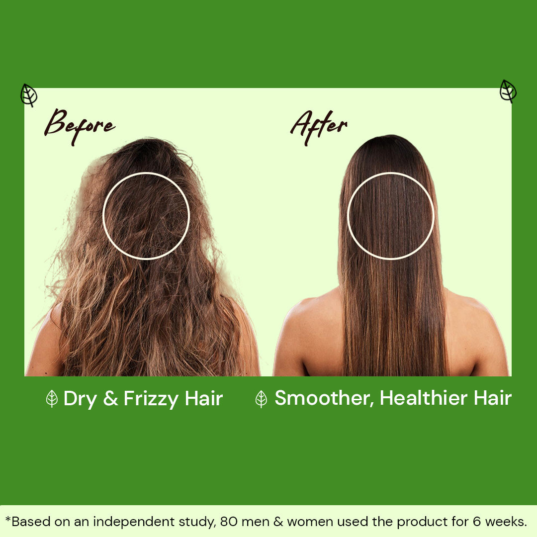 Atulya Cold Pressed Neem Oil | Fights Acne & Scalp Issues | Multipurpose Use | 200 ml