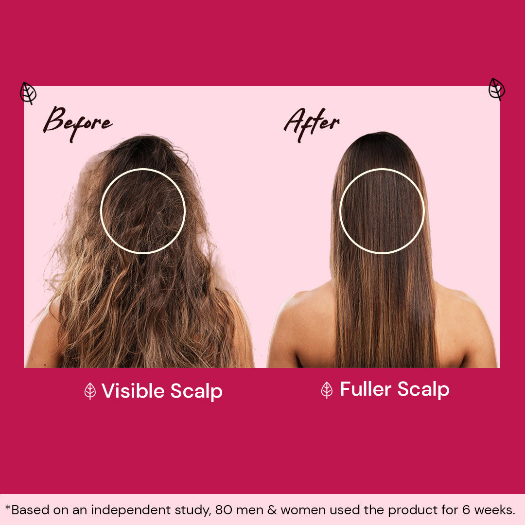 Atulya Onion & Bhringraj Shampoo | Deep Cleanse, Scalp Nourishment | 300 ml