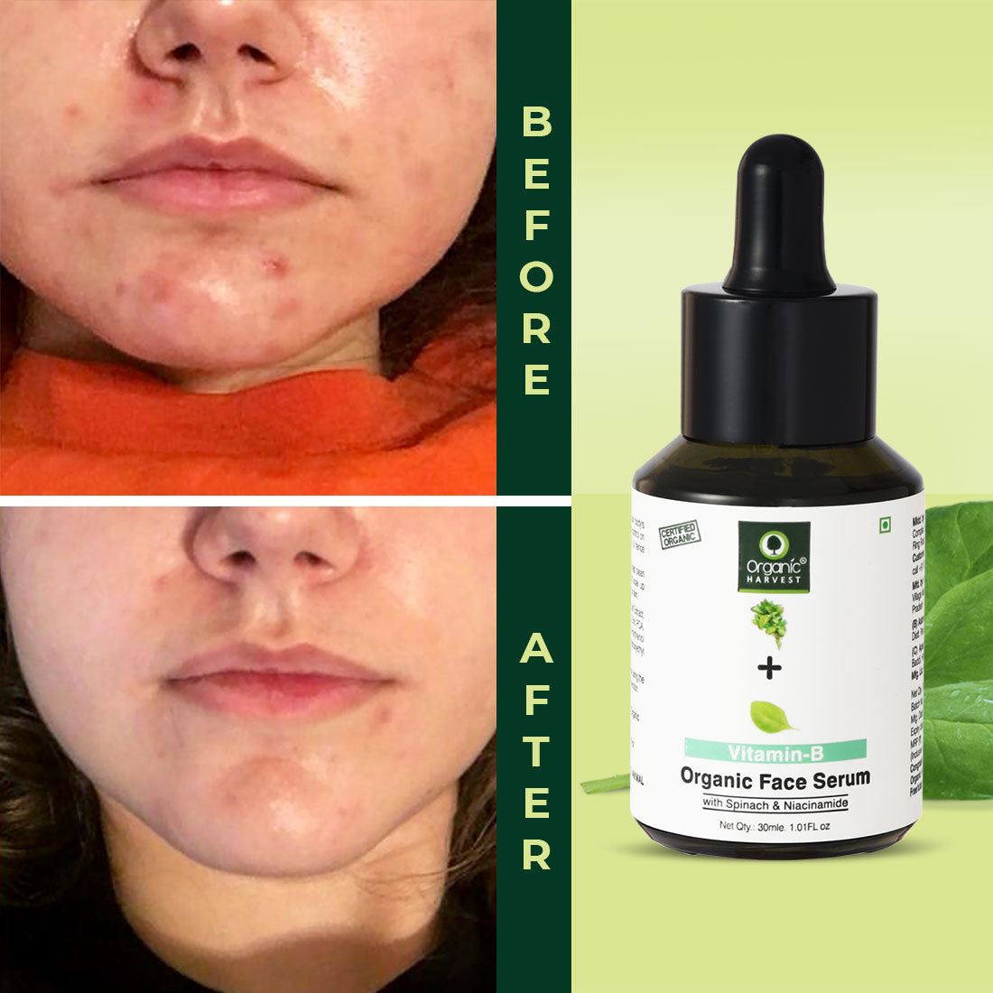 Acne Control Mattifying Face Serum with Green Tea & Moringa Extracts - 30ml