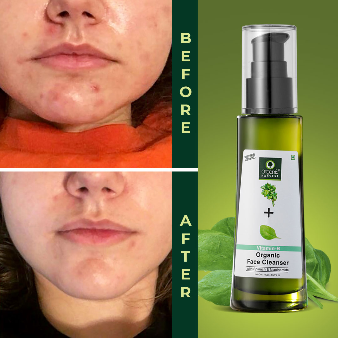 Acne Control Mattifying Face Cleanser with Green Tea, Moringa & Aloe Vera - 100ml