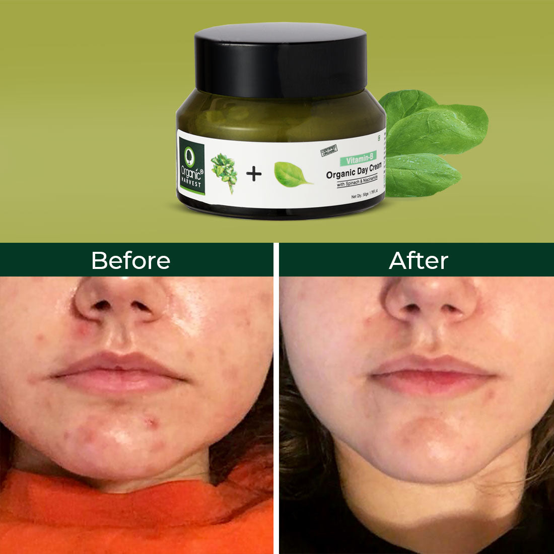 Acne Control Mattifying Day Cream: Green Tea & Moringa | For Acne-prone Skin - 50gm