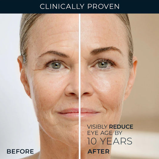 RoC RETINOL CORREXION® Line Smoothing Eye Cream - 15 ml