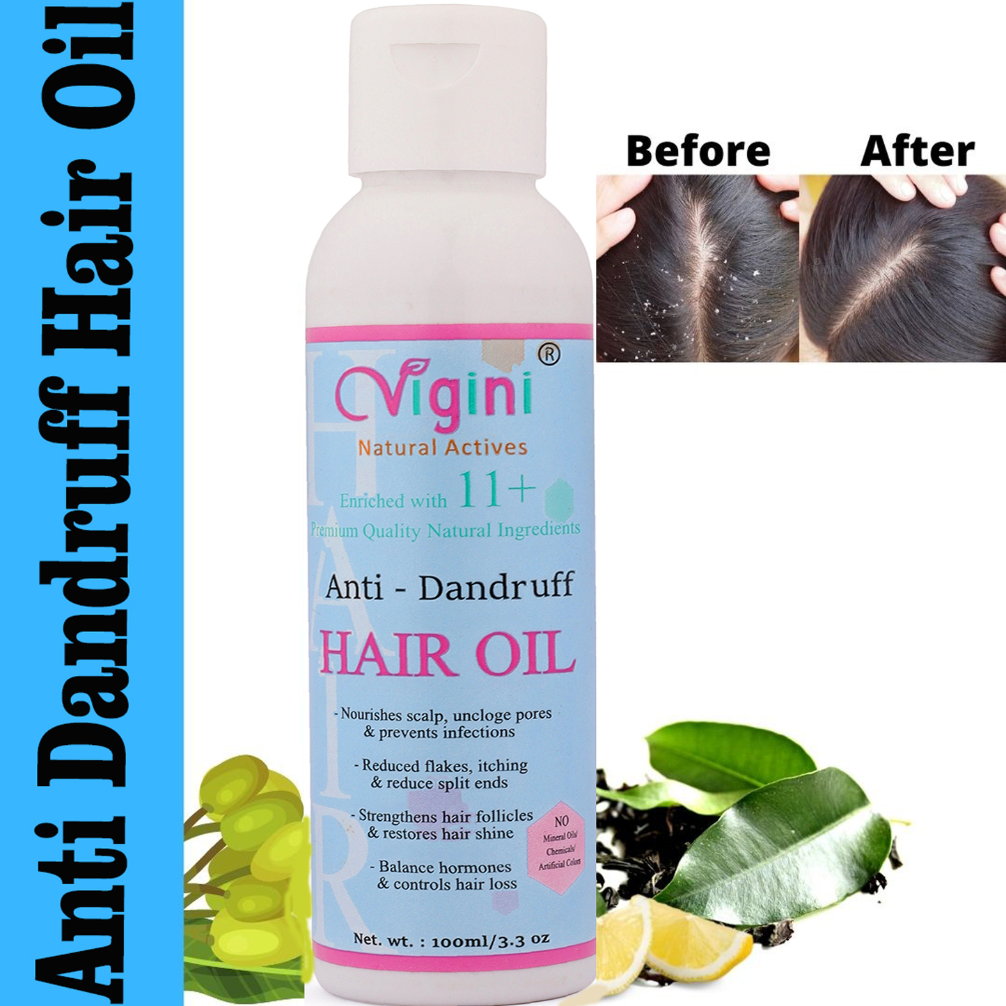 Anti-Dandruff Hair Oil